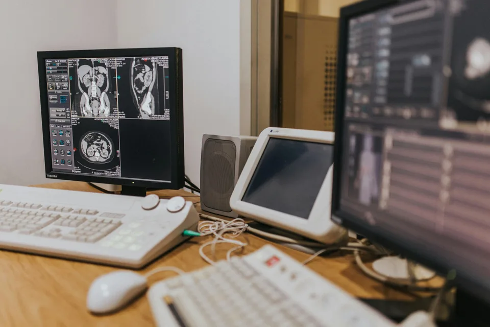 Medical body imaging displayed on a computer screen in a hospital setting.