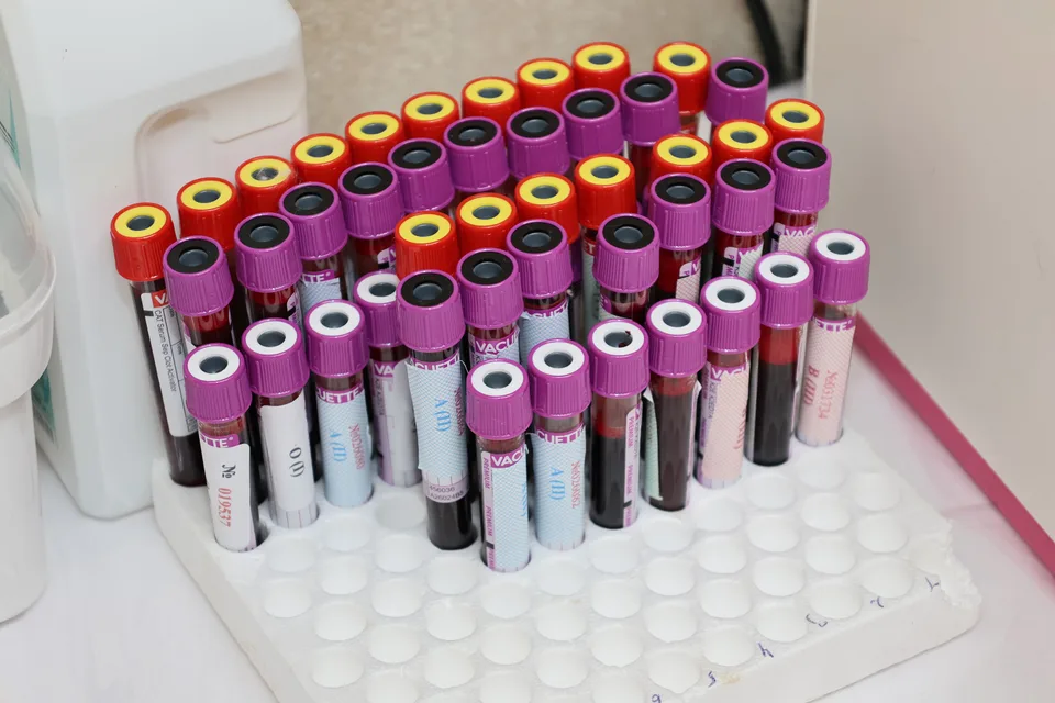 rows of capped blood sample tubes in a white laboratory rack