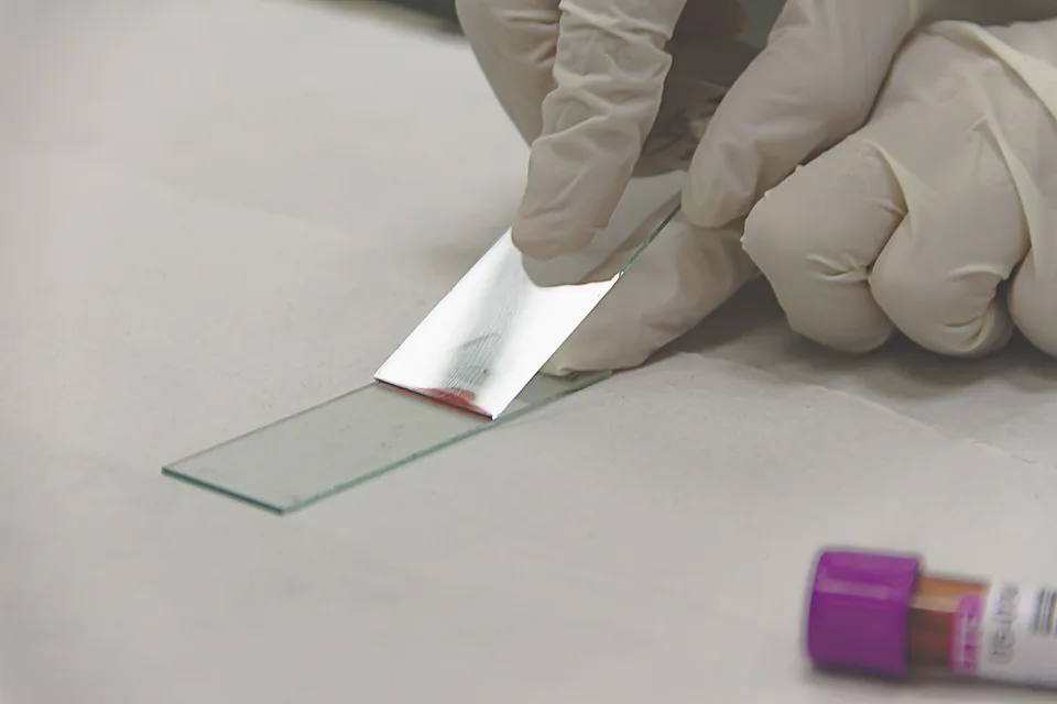 A person holding two laboratory slides used for microscopic tissue examination.