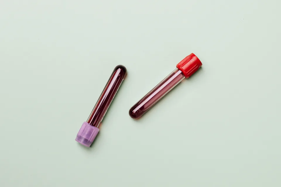 two blood sample tubes on a plain pale green background